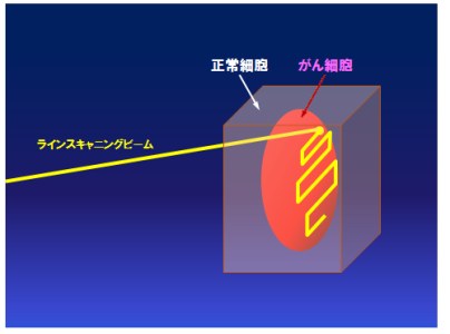 ラインスキャニング照射法(イメージ図)